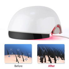 Load image into Gallery viewer, VolumeMax Hair Growth Helmet 162 Laser Diodes - FDA Cleared