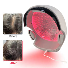 Load image into Gallery viewer, VolumeMax Hair Growth Helmet 162 Laser Diodes - FDA Cleared